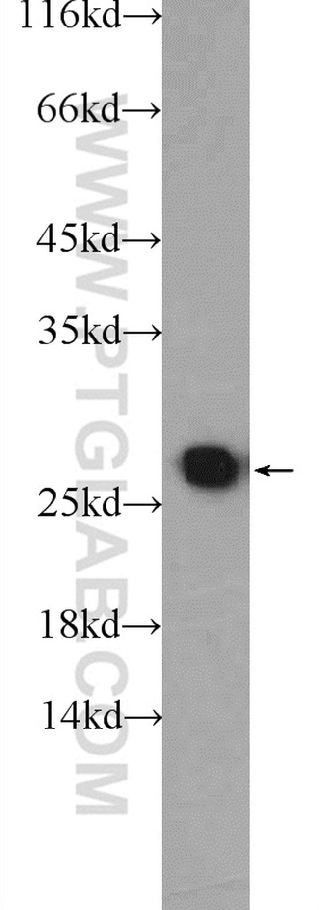 PSMA2 Antibody in Western Blot (WB)