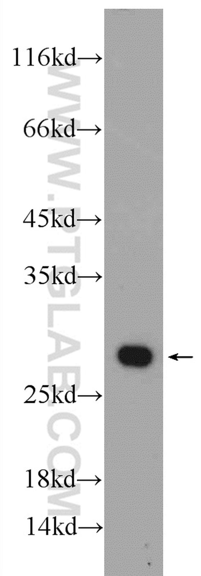 PSMA2 Antibody in Western Blot (WB)