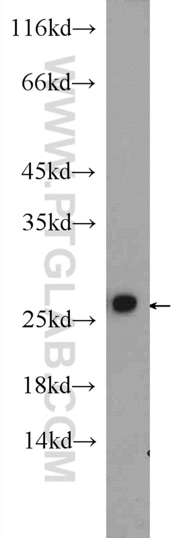 PSMA2 Antibody in Western Blot (WB)