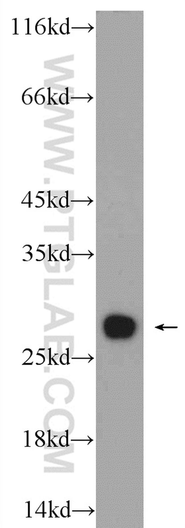 PSMA2 Antibody in Western Blot (WB)