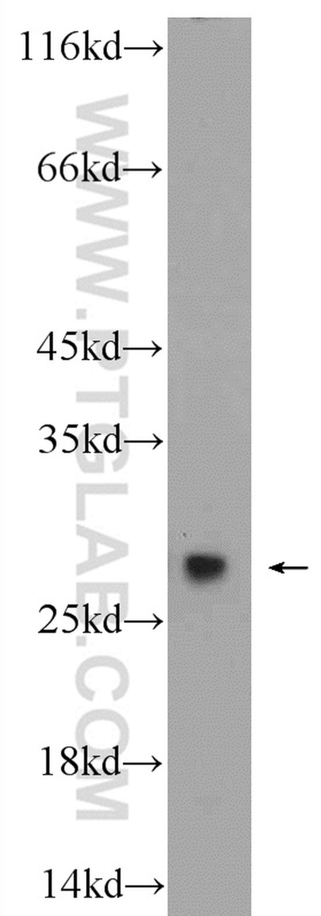 PSMA2 Antibody in Western Blot (WB)