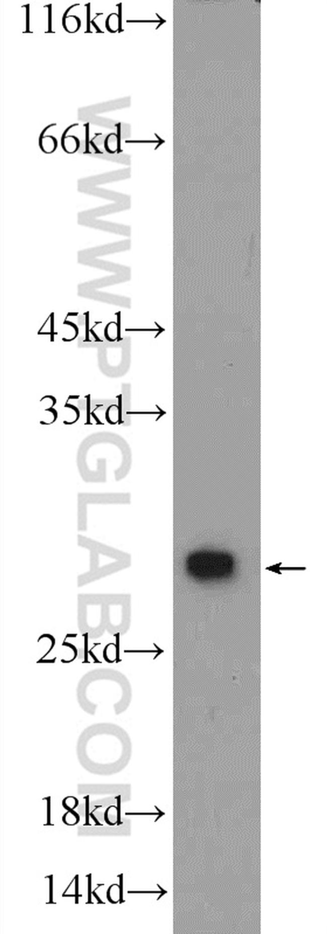 PSMA2 Antibody in Western Blot (WB)