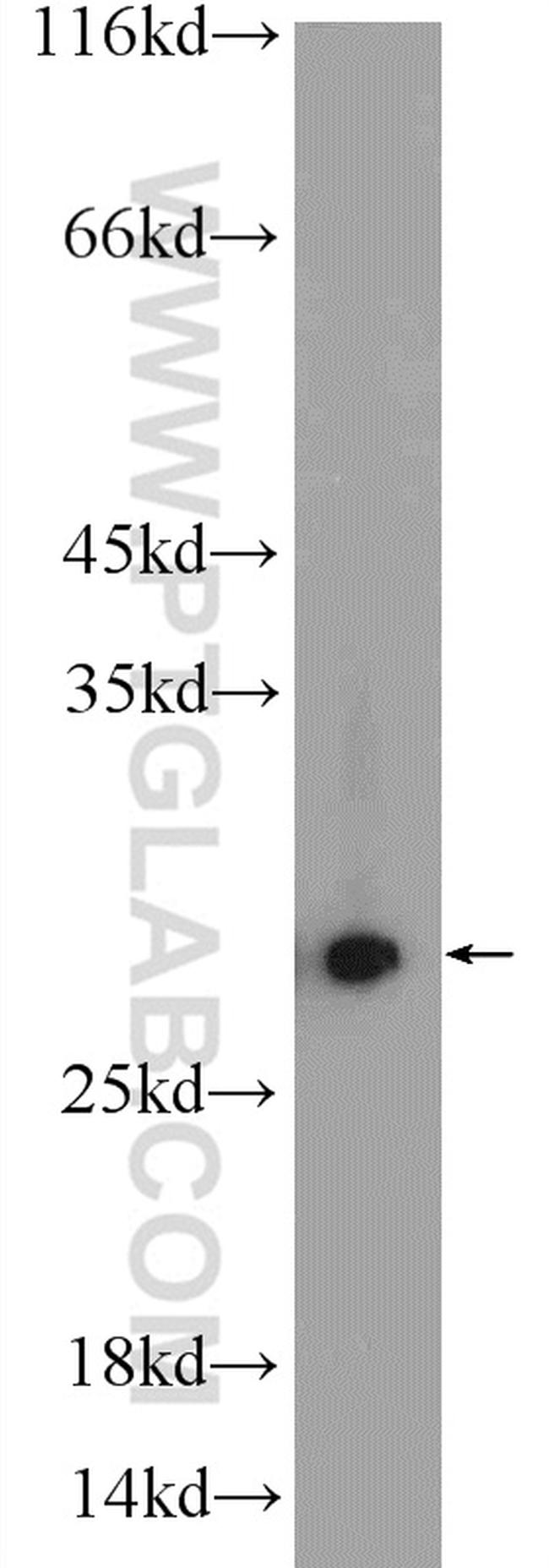 PSMA2 Antibody in Western Blot (WB)