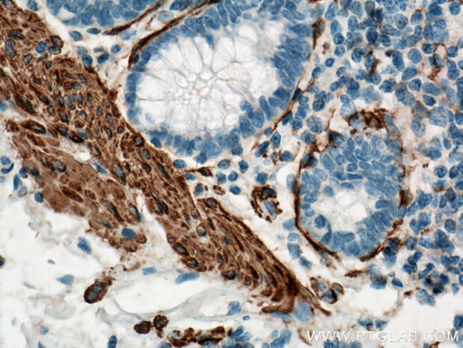 ACTA2/smooth muscle actin Antibody in Immunohistochemistry (Paraffin) (IHC (P))