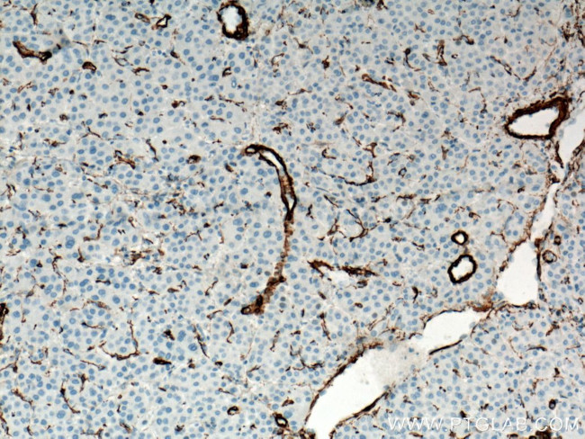 ACTA2/smooth muscle actin Antibody in Immunohistochemistry (Paraffin) (IHC (P))