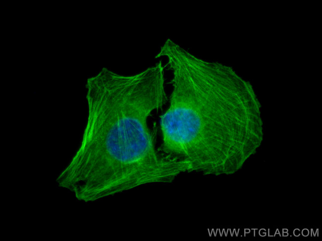 ACTA2/smooth muscle actin Antibody in Immunocytochemistry (ICC/IF)