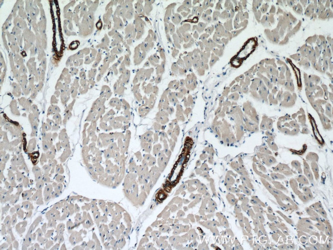 ACTA2/smooth muscle actin Antibody in Immunohistochemistry (Paraffin) (IHC (P))