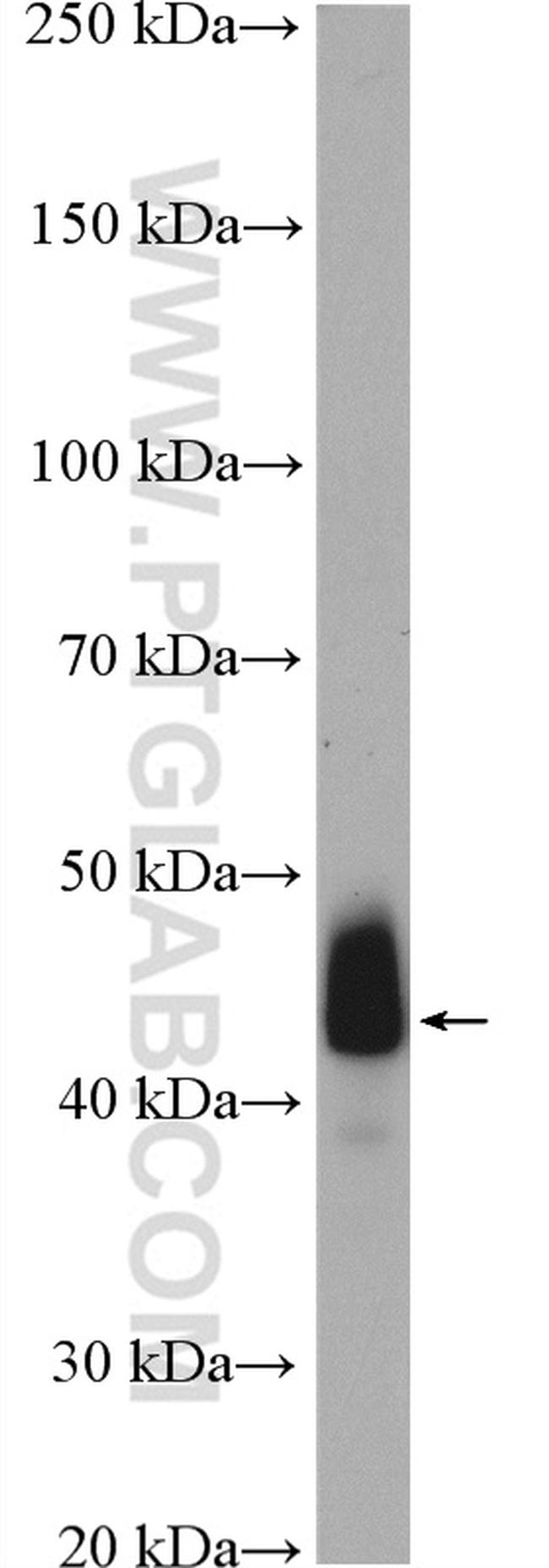 ACTA2/smooth muscle actin Antibody in Western Blot (WB)