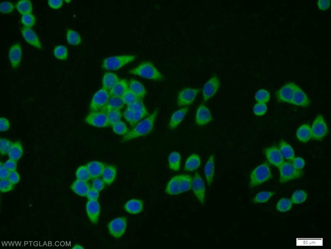 SCPx Antibody in Immunocytochemistry (ICC/IF)