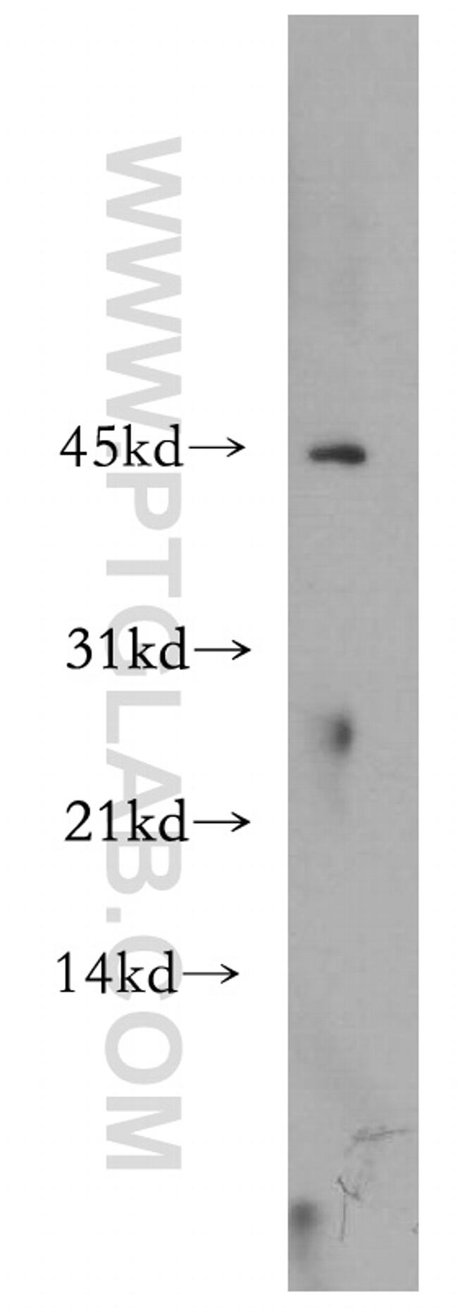 SCPx Antibody in Western Blot (WB)