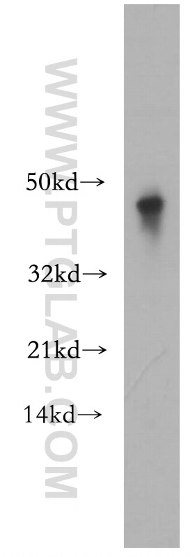 SCPx Antibody in Western Blot (WB)