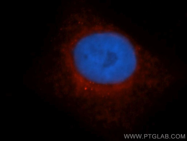 LDHD Antibody in Immunocytochemistry (ICC/IF)