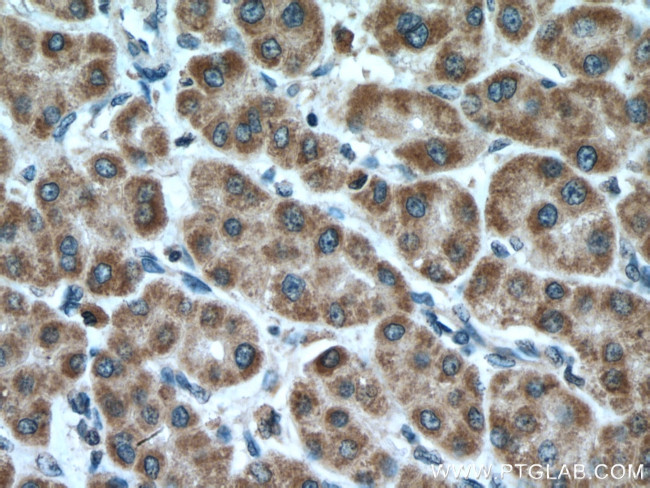 LDHD Antibody in Immunohistochemistry (Paraffin) (IHC (P))