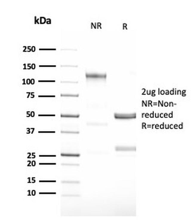 Granulocyte-Colony Stimulating Factor (G-CSF) Antibody in SDS-PAGE (SDS-PAGE)