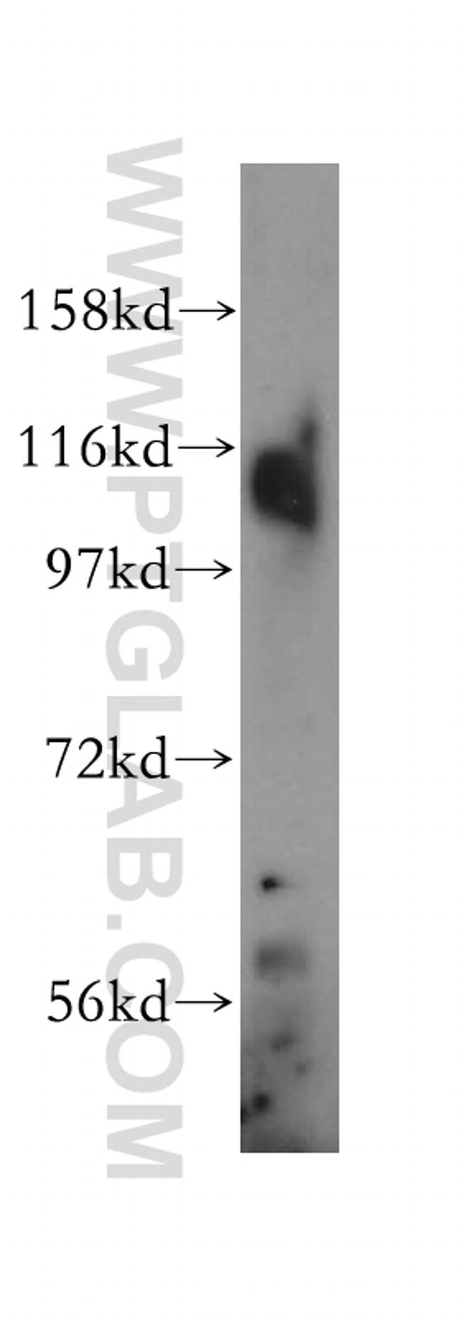 IPO11 Antibody in Western Blot (WB)