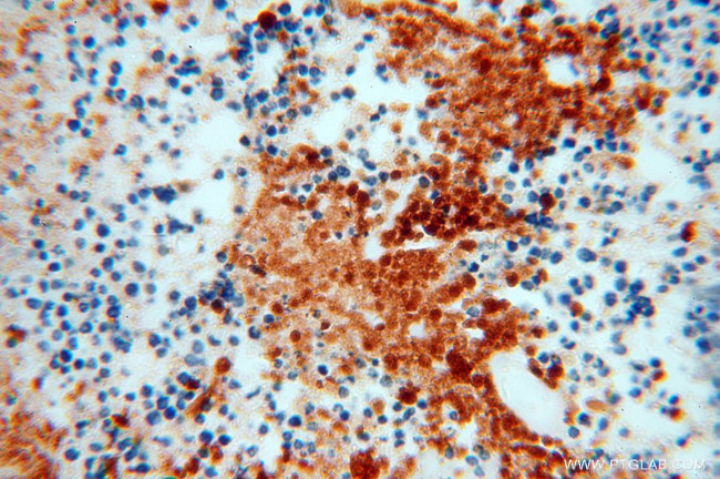 IPO11 Antibody in Immunohistochemistry (Paraffin) (IHC (P))