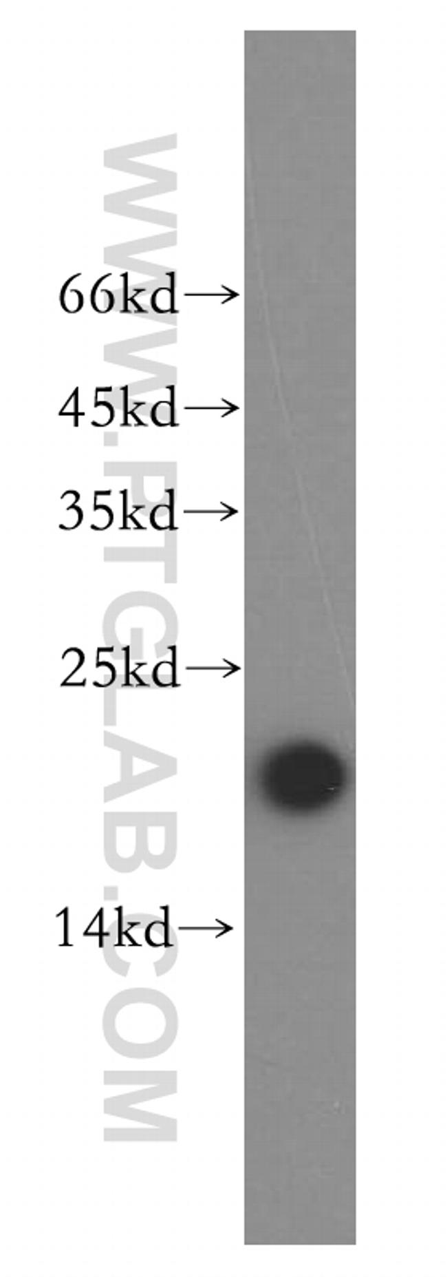 UBE2L3 Antibody in Western Blot (WB)