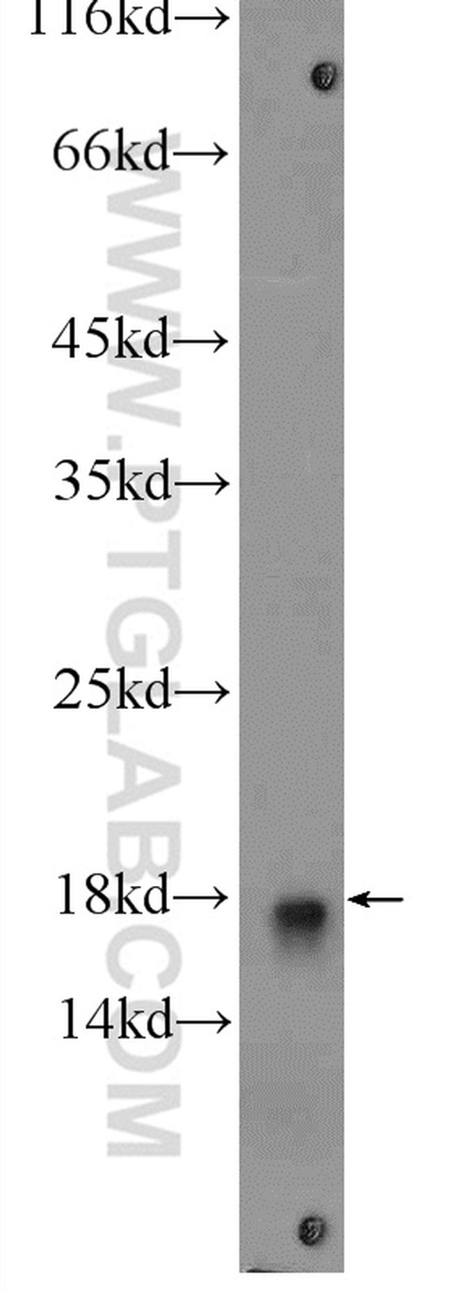 UBE2L3 Antibody in Western Blot (WB)