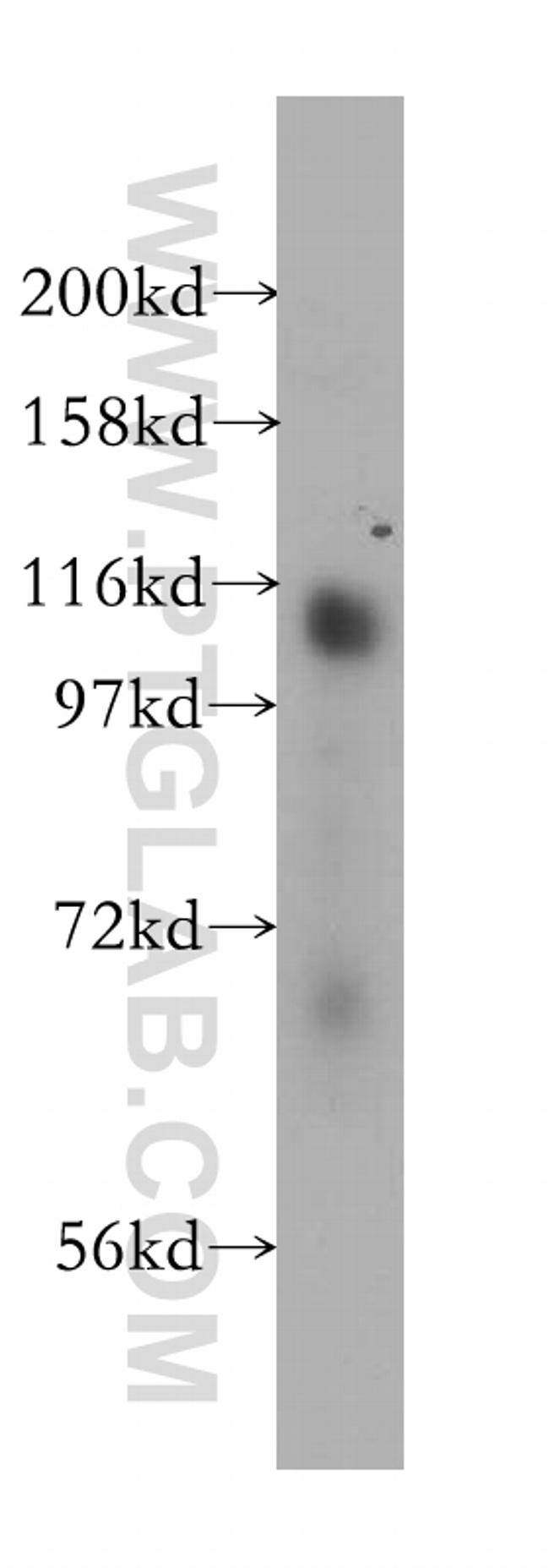 RBM10 Antibody in Western Blot (WB)