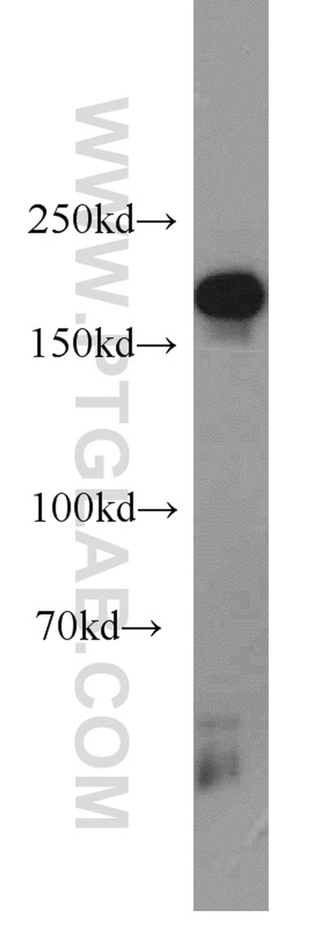 KDM5C Antibody in Western Blot (WB)