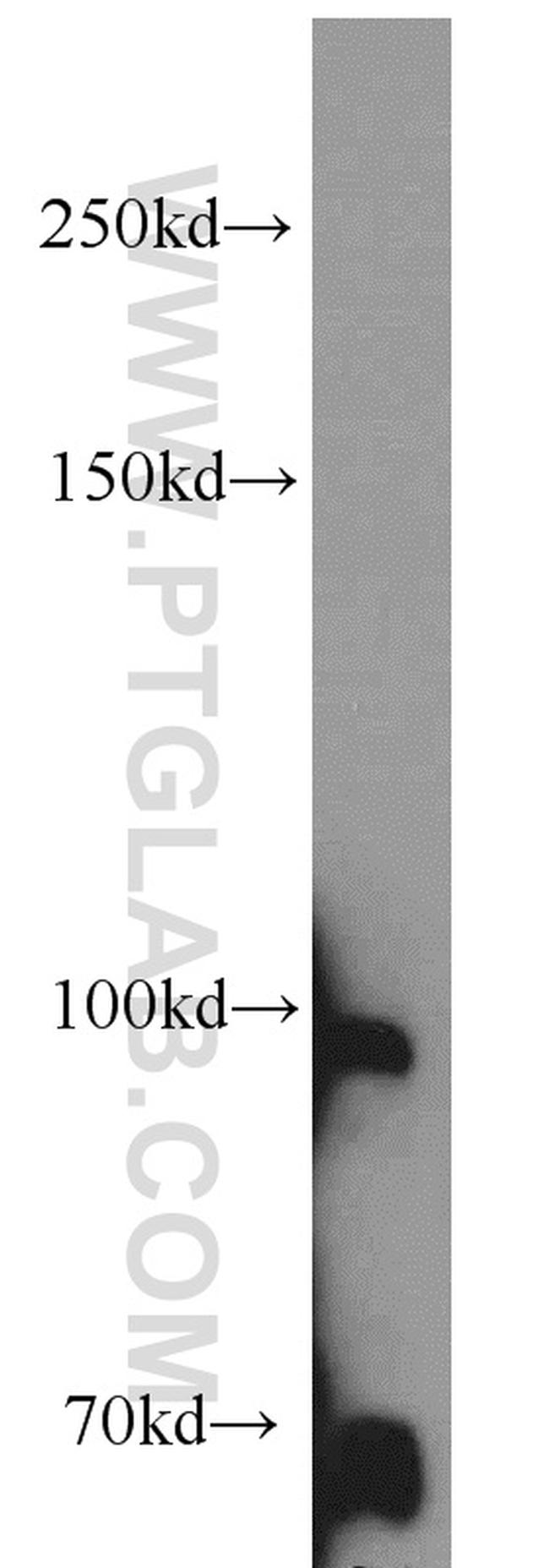 TFIP11 Antibody in Western Blot (WB)