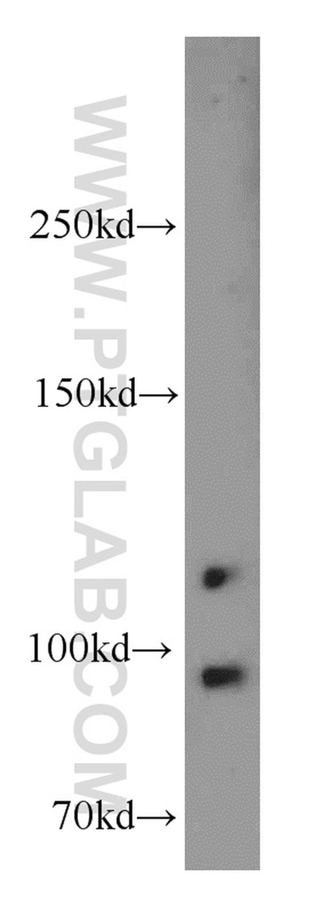 TFIP11 Antibody in Western Blot (WB)