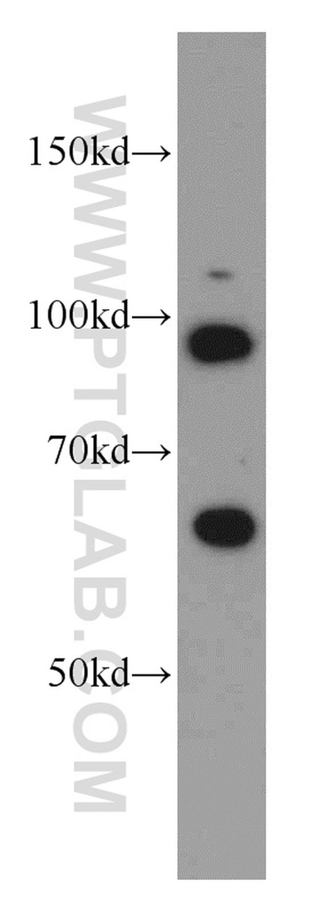 TFIP11 Antibody in Western Blot (WB)