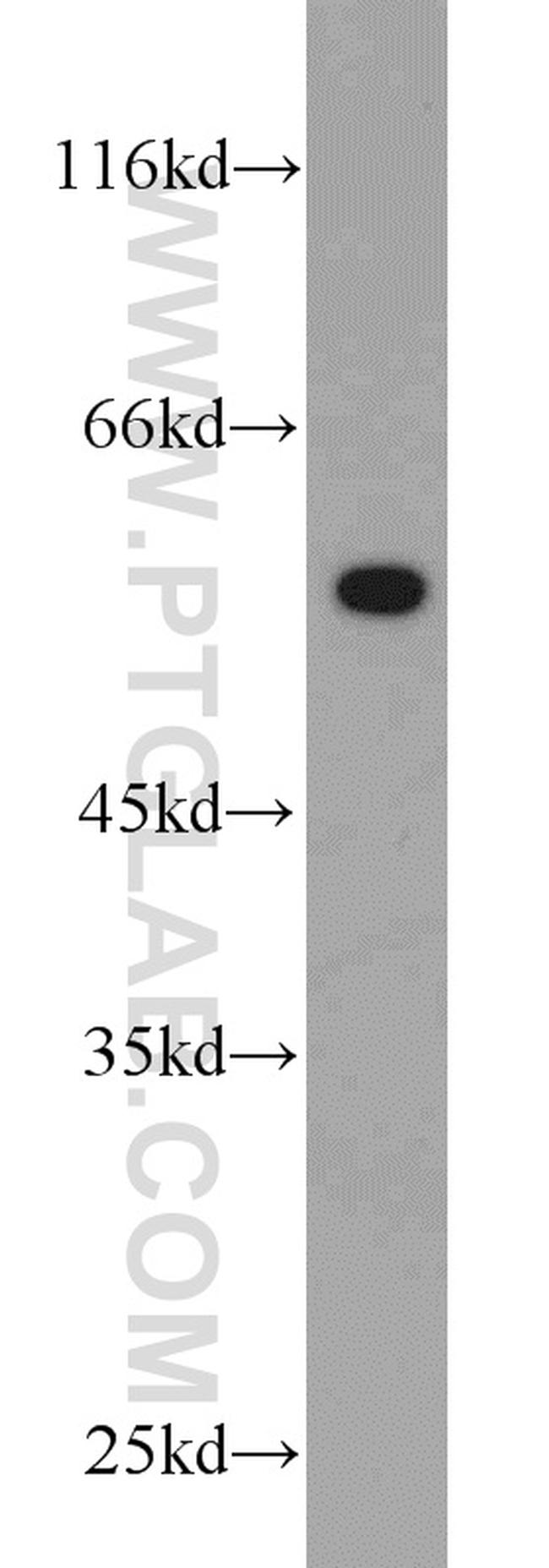 V5-tag Antibody in Western Blot (WB)