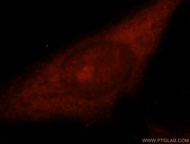 TSG101 Antibody in Immunocytochemistry (ICC/IF)