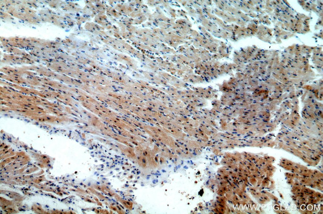 TSG101 Antibody in Immunohistochemistry (Paraffin) (IHC (P))