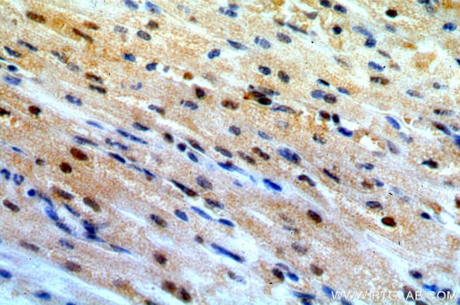 TSG101 Antibody in Immunohistochemistry (Paraffin) (IHC (P))