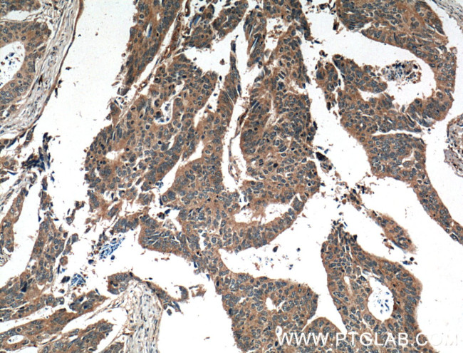 TSG101 Antibody in Immunohistochemistry (Paraffin) (IHC (P))