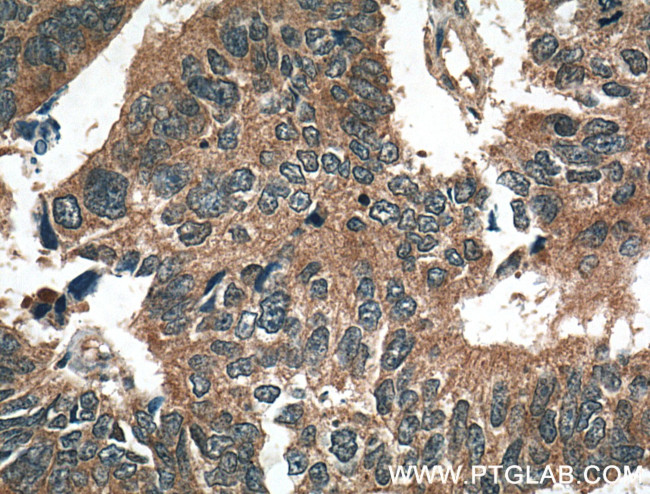 TSG101 Antibody in Immunohistochemistry (Paraffin) (IHC (P))