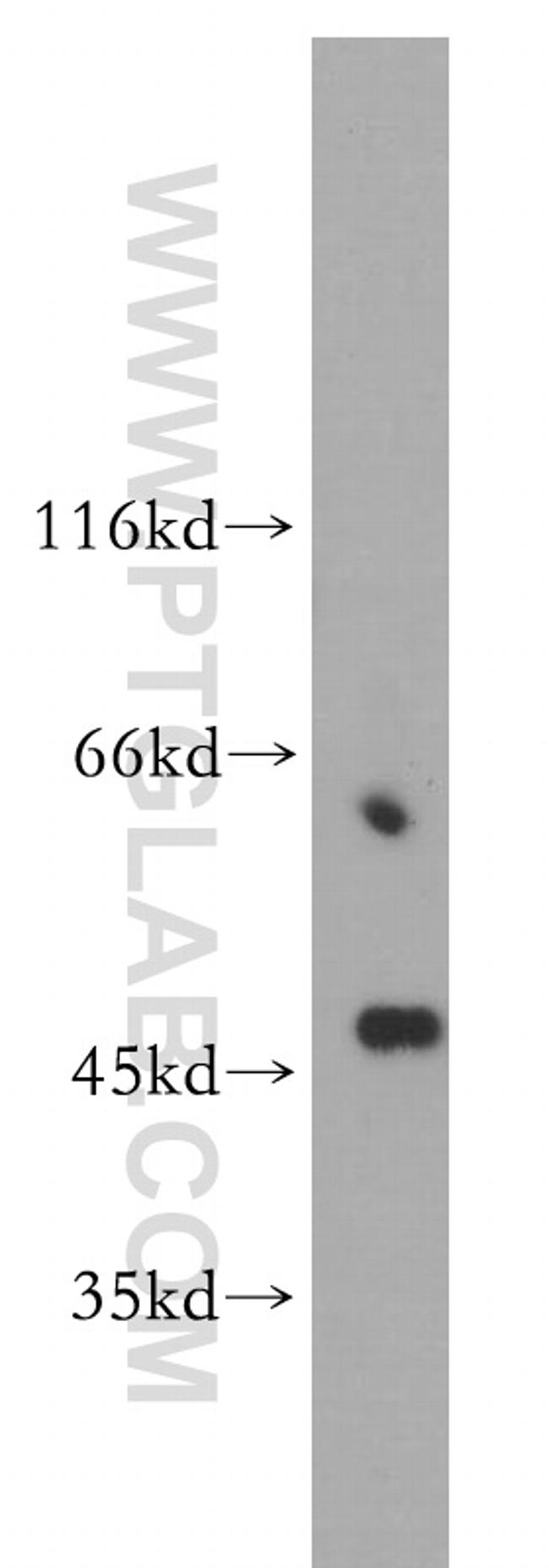 TSG101 Antibody in Western Blot (WB)