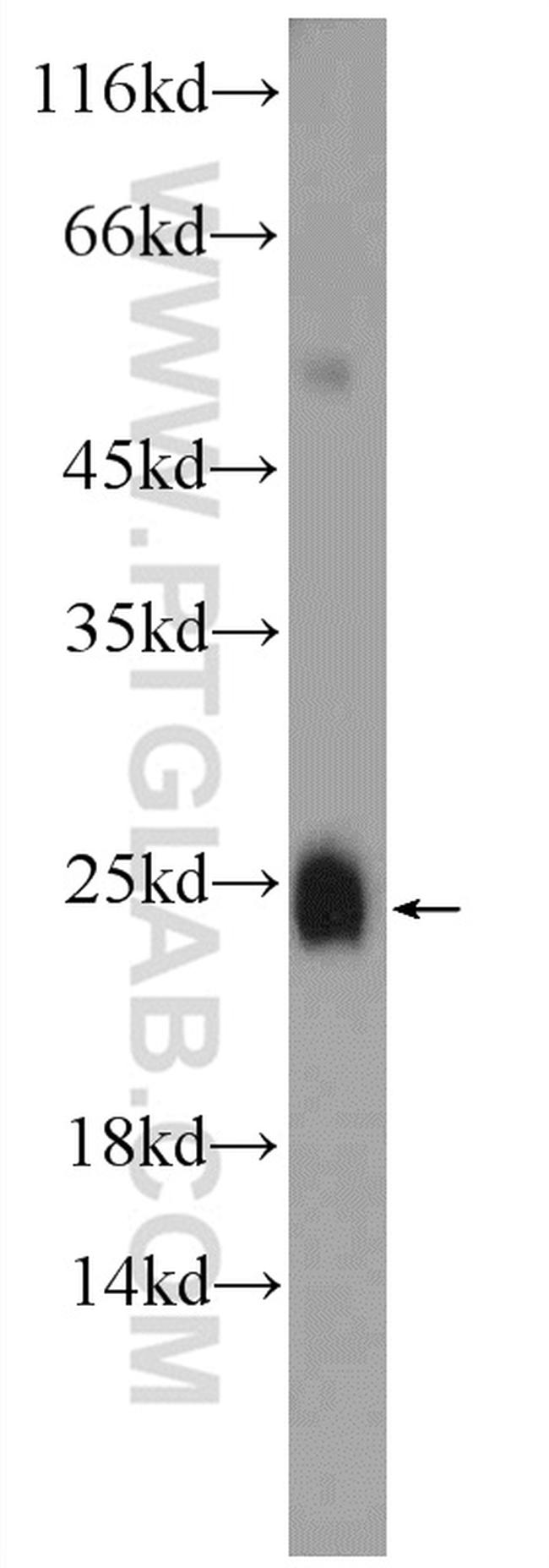 PRM2 Antibody in Western Blot (WB)