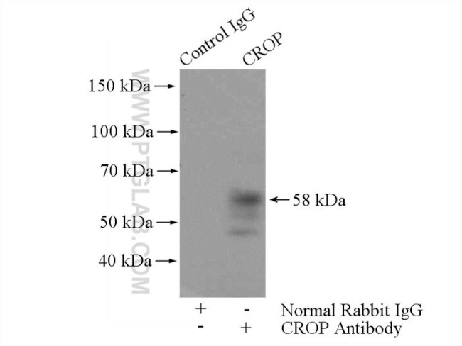 CROP Antibody in Immunoprecipitation (IP)