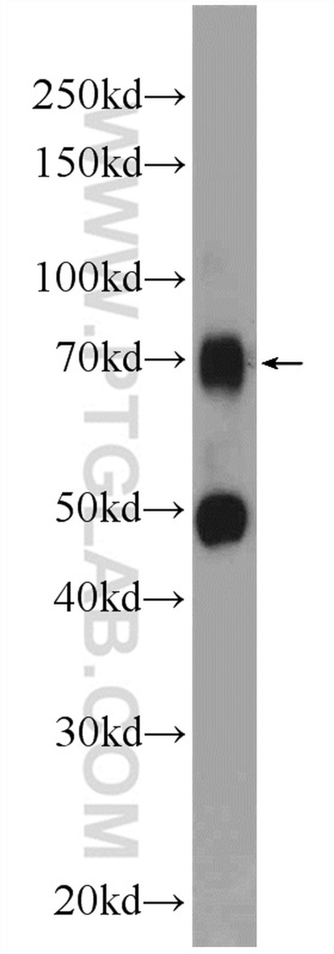 NR1D1 Antibody in Western Blot (WB)