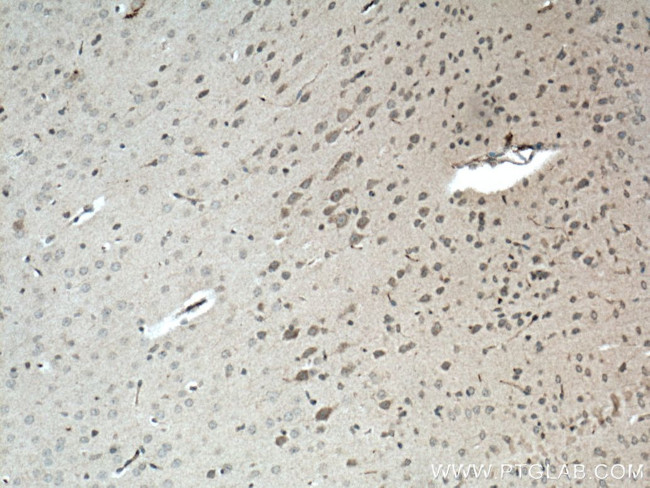 SREBF2 Antibody in Immunohistochemistry (Paraffin) (IHC (P))