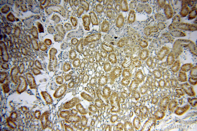 SREBF2 Antibody in Immunohistochemistry (Paraffin) (IHC (P))