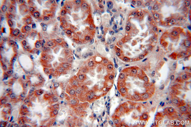 SREBF2 Antibody in Immunohistochemistry (Paraffin) (IHC (P))