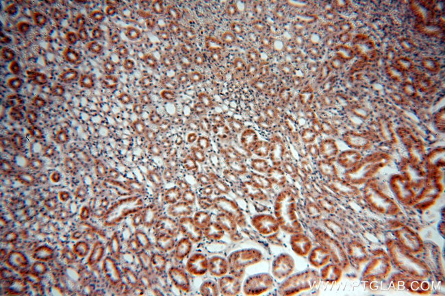 SREBF2 Antibody in Immunohistochemistry (Paraffin) (IHC (P))