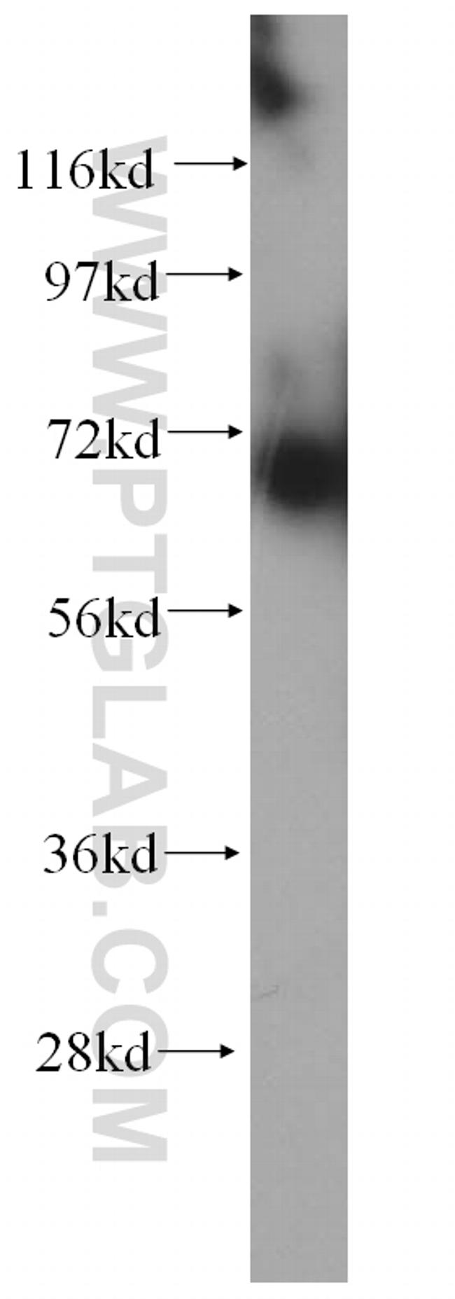 SREBF2 Antibody in Western Blot (WB)