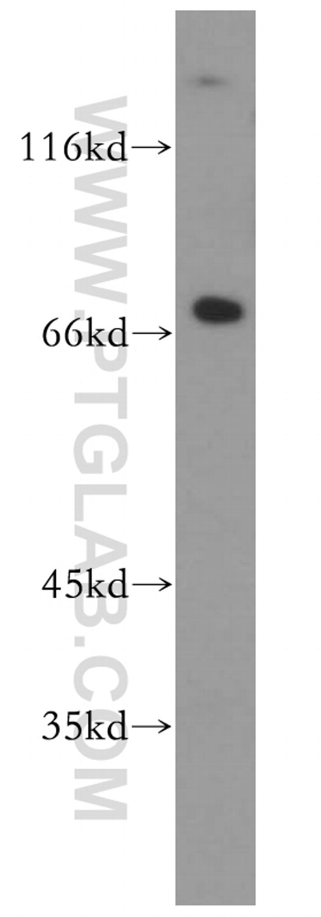 SREBF2 Antibody in Western Blot (WB)