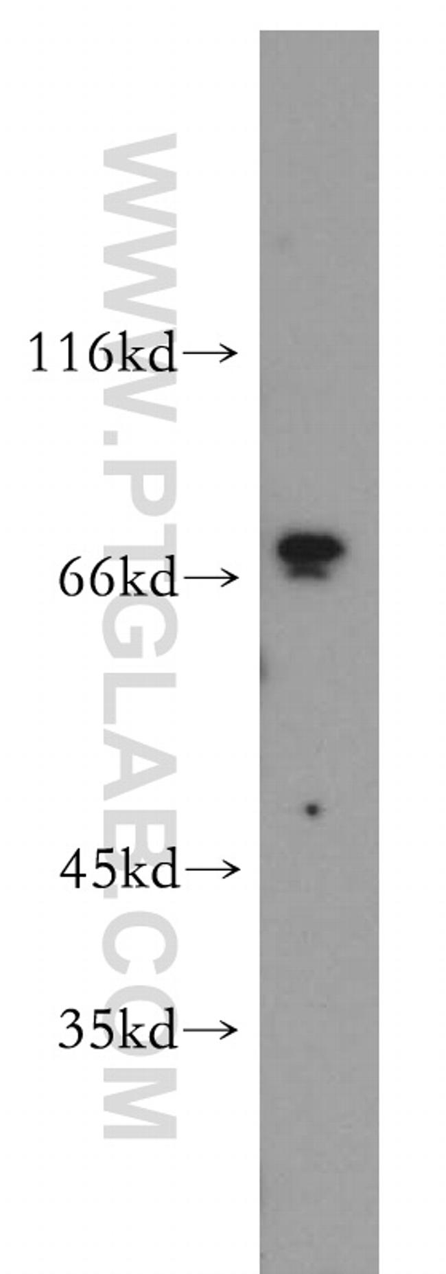 SREBF2 Antibody in Western Blot (WB)