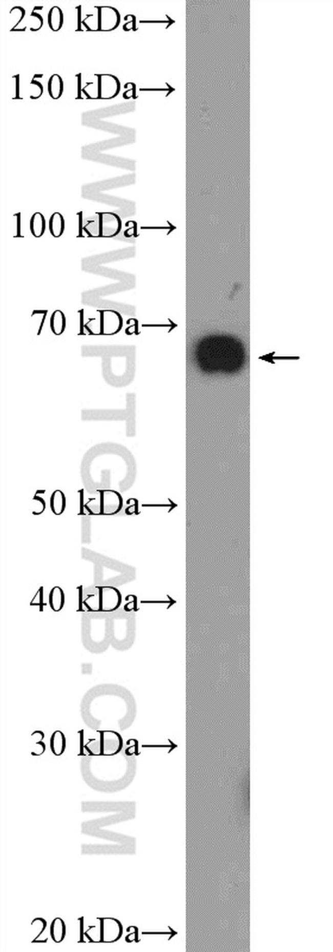 SREBF2 Antibody in Western Blot (WB)