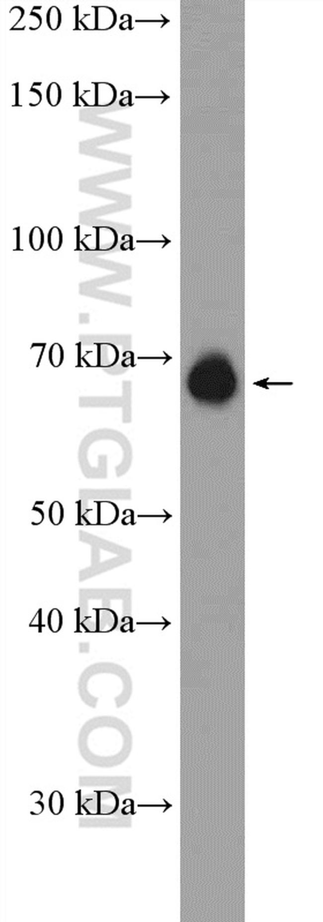 SREBF2 Antibody in Western Blot (WB)