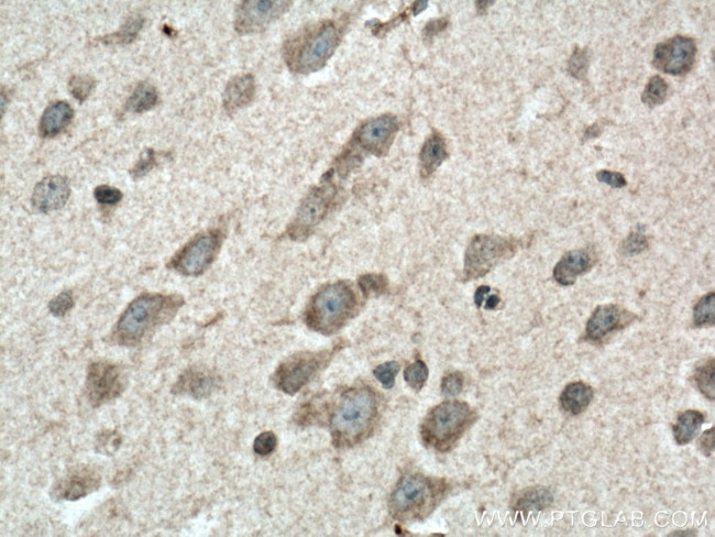 SREBF2 Antibody in Immunohistochemistry (Paraffin) (IHC (P))