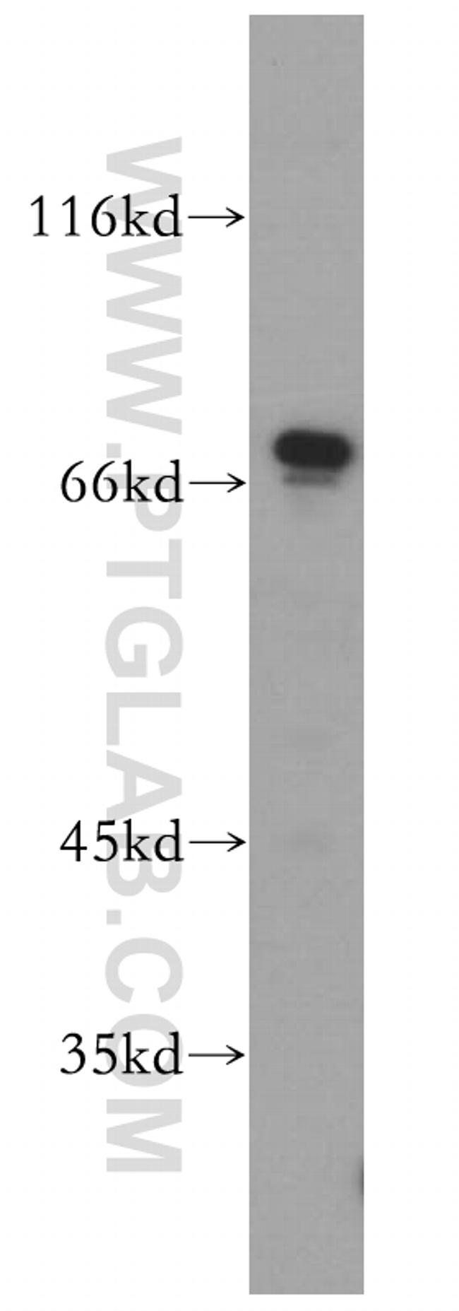 SREBF2 Antibody in Western Blot (WB)