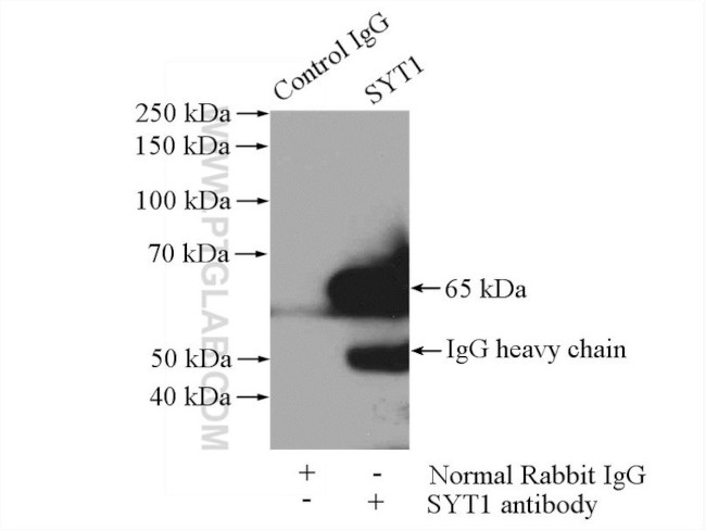 Synaptotagmin-1 Antibody in Immunoprecipitation (IP)