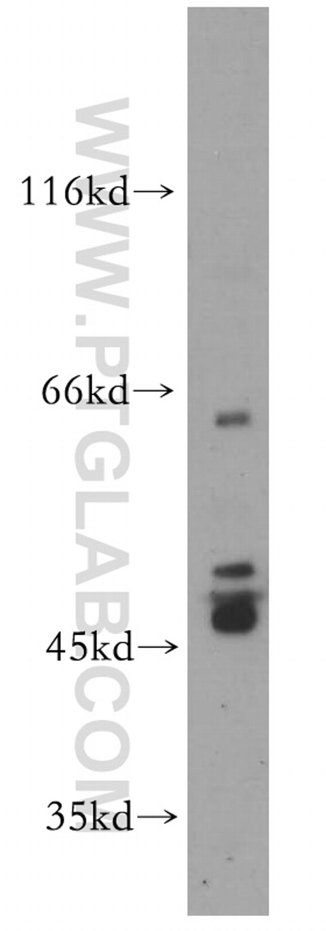 PTPN5 Antibody in Western Blot (WB)